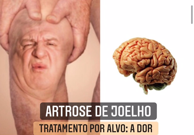 artrose de joelho e dor