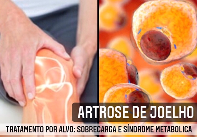 artrose de joelho e síndrome metabólica