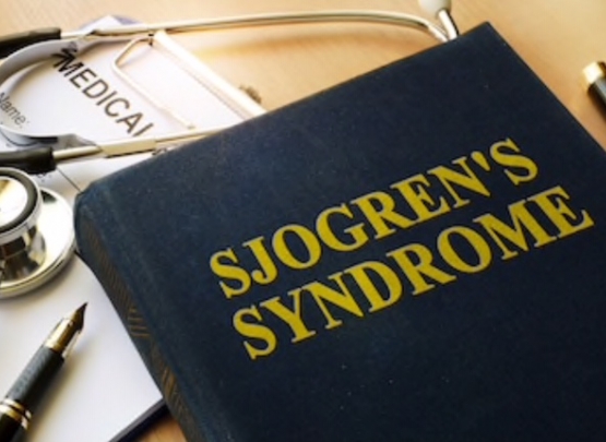 Síndrome de Sjögren 