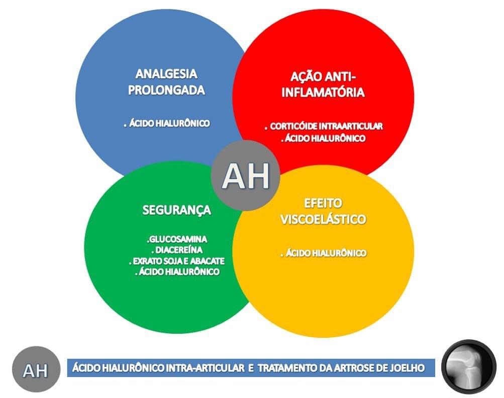 artrose de joelho e ácido hialurônico 