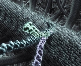 esclerodermia 