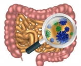 Intestino e reumatismo 