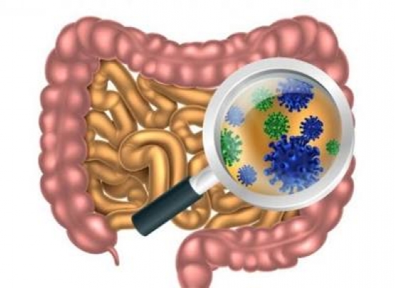 Intestino e reumatismo 