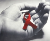 Reumatismo HIV 