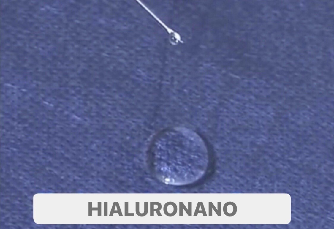 hialuronano