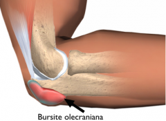 olecraniana